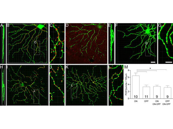 Immunofluorescence using GFP DyLight488